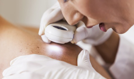 Skin Cancer Evaluation and Diagnosis NYC